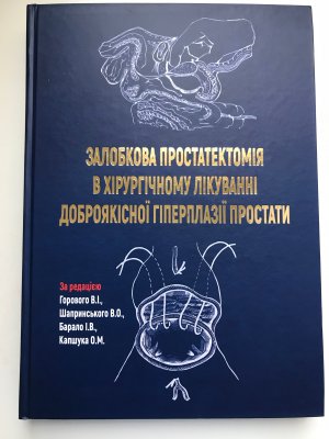 Залобкова простатектомія в хірургічному лікуванні гіперплазії простати